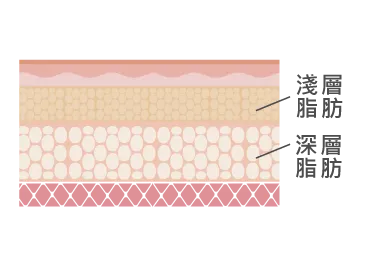 深淺層脂肪-桃園抽脂推薦
