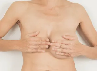 不滿意自身胸型-魔滴2.0隆乳-桃園隆乳推薦