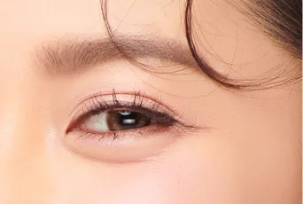 告別泡泡眼-桃園割雙眼皮推薦