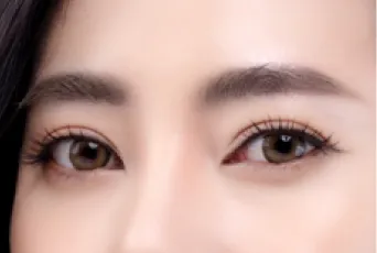 多樣化線條皆可打造-桃園割雙眼皮推薦