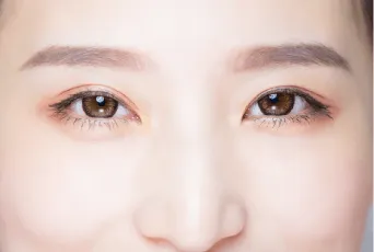 雙眼皮不對稱者-桃園割雙眼皮推薦