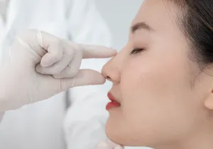 隆鼻手術施作流程-桃園隆鼻推薦
