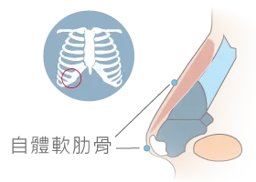 全自體隆鼻-桃園鼻雕推薦