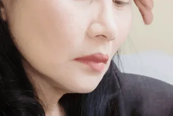 因年齡而嘴角下垂者-桃園微笑唇