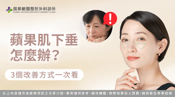 蘋果肌下垂怎麼辦-蘋果肌下垂