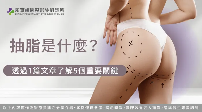 抽脂是什麼-如何抽脂