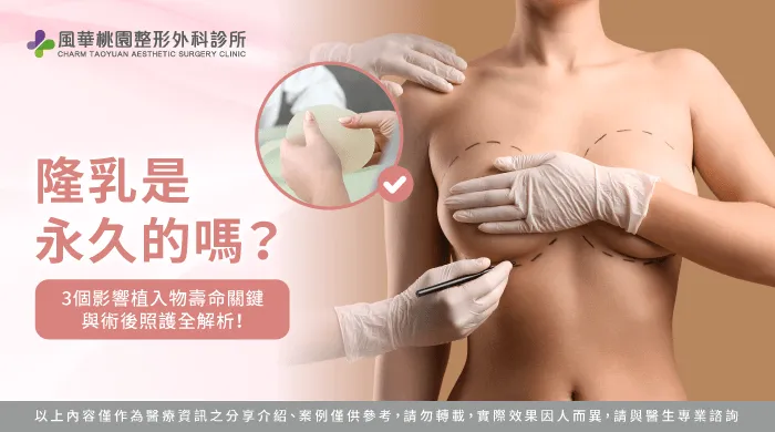 隆乳是永久的嗎解析與評估-隆乳是永久的嗎