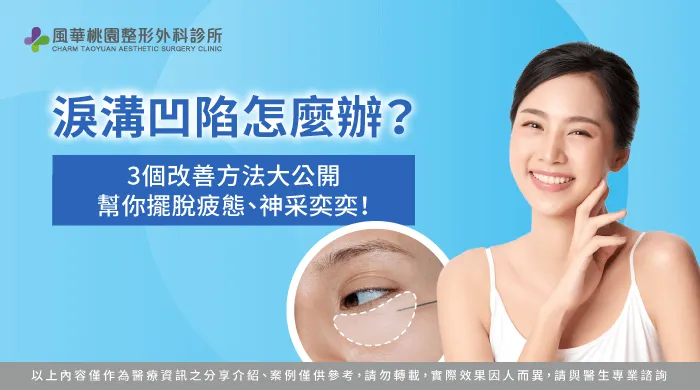 淚溝凹陷怎麼辦-桃園骨水泥整形推薦