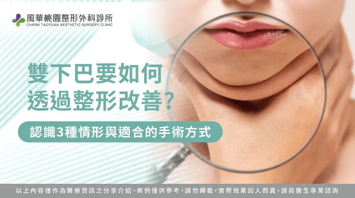 雙下巴 整形-桃園骨水泥手術推薦