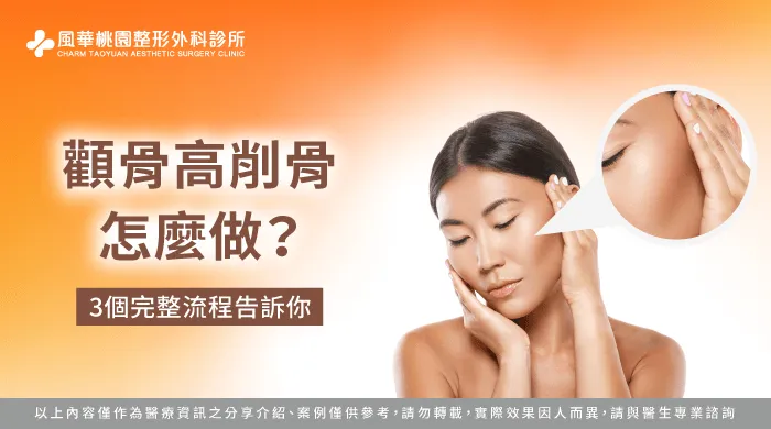 顴骨高 削骨-桃園削骨推薦