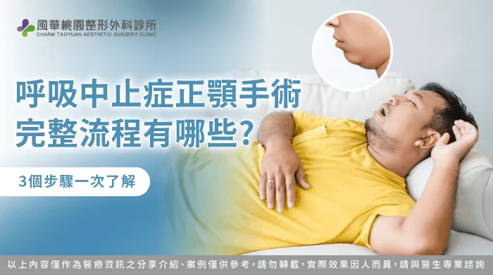 呼吸中止症 正顎手術-呼吸中止症 正顎