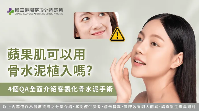 蘋果肌凹陷 骨水泥-桃園骨水泥整形推薦