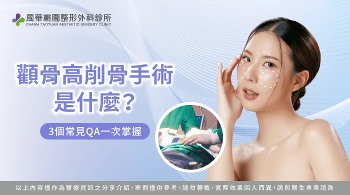 顴骨高 削骨-桃園削骨推薦