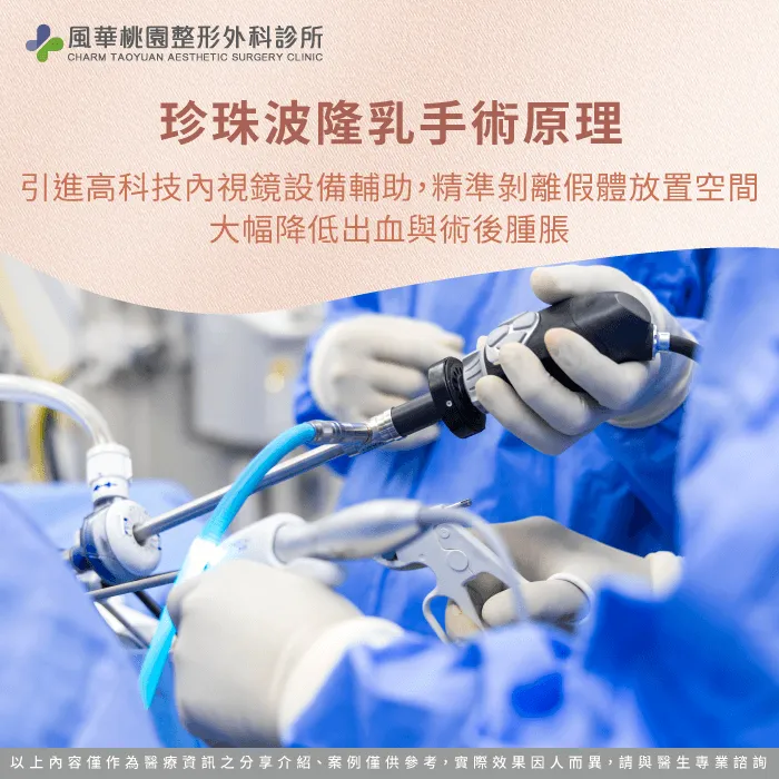 珍珠波隆乳手術原理-珍珠波隆乳是什麼