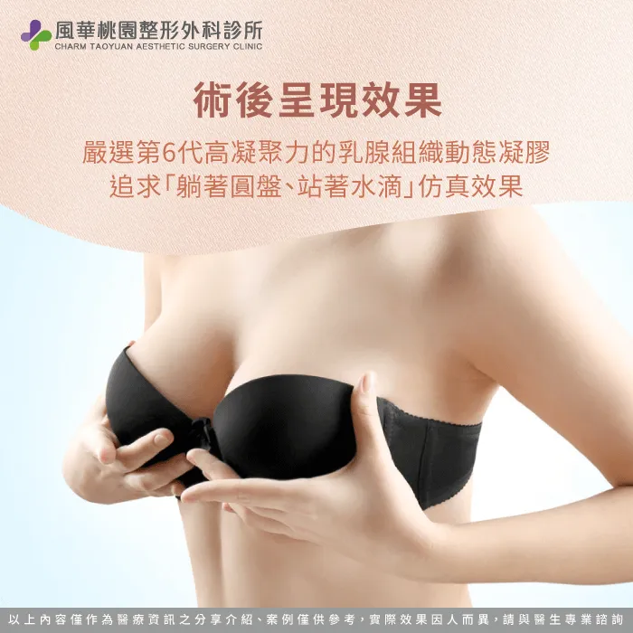 珍珠波隆乳效果-珍珠波隆乳是什麼