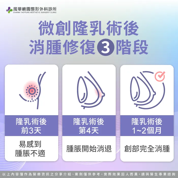 隆乳術後消腫3階段-隆乳多久消腫-桃園隆乳推薦