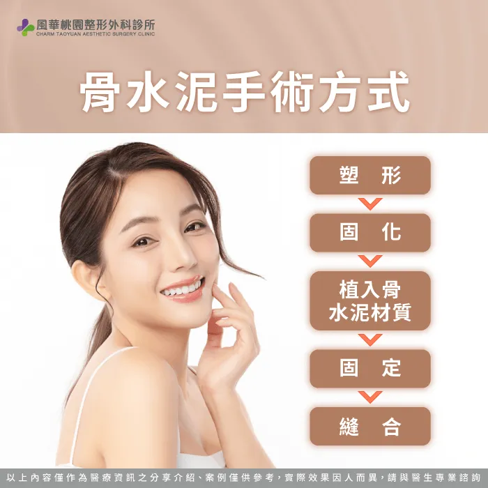 骨水泥手術方式-骨水泥要住院嗎