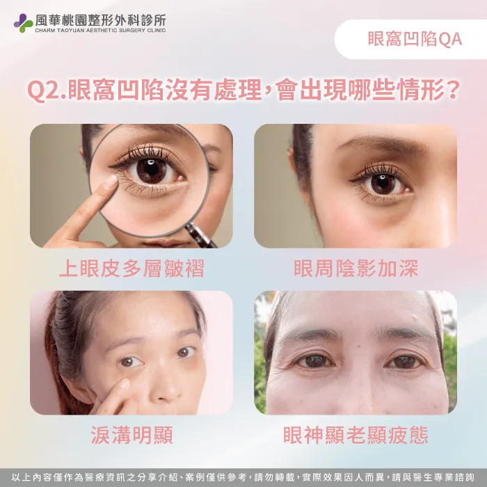 眼窩凹陷沒有處理會如何-眼窩凹陷怎麼辦