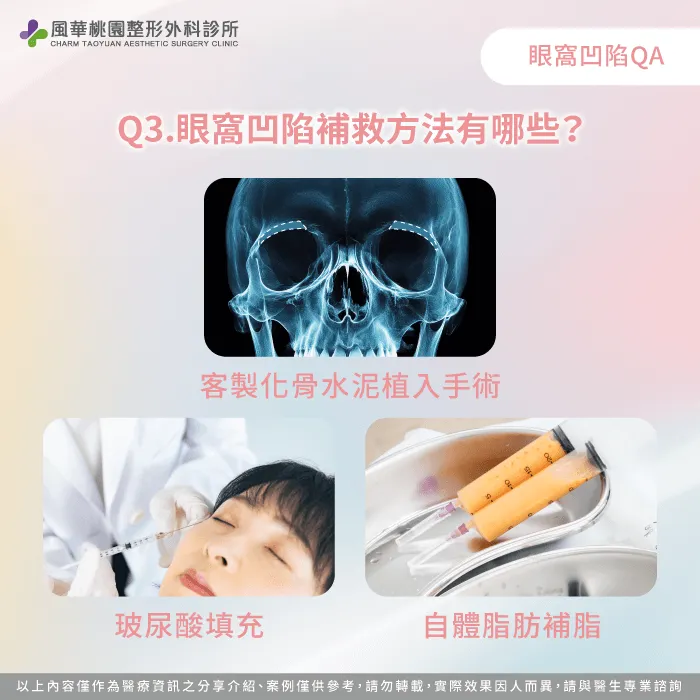 眼窩凹陷改善方法-眼窩凹陷怎麼辦