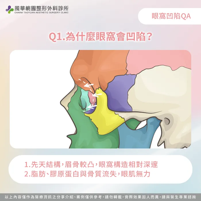為什麼眼窩凹陷-眼窩凹陷怎麼辦