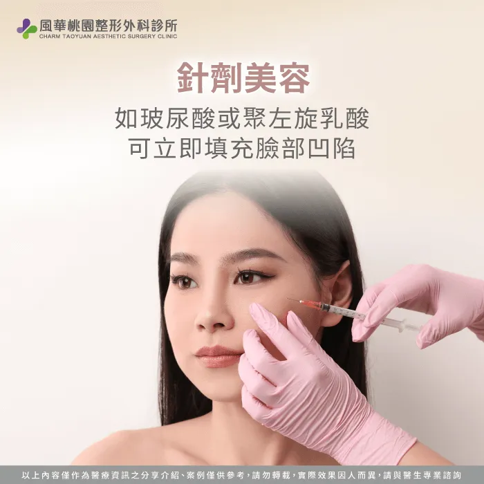 針劑美容填充-蘋果肌下垂怎麼辦