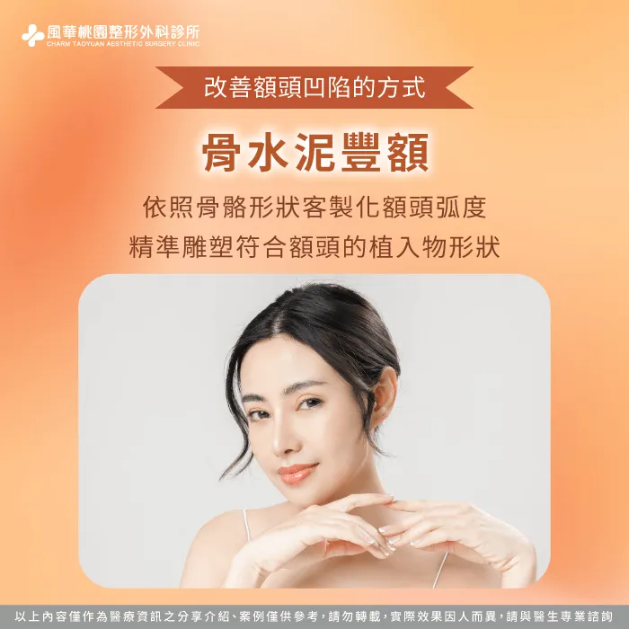 骨水泥豐額-額頭凹陷怎麼辦