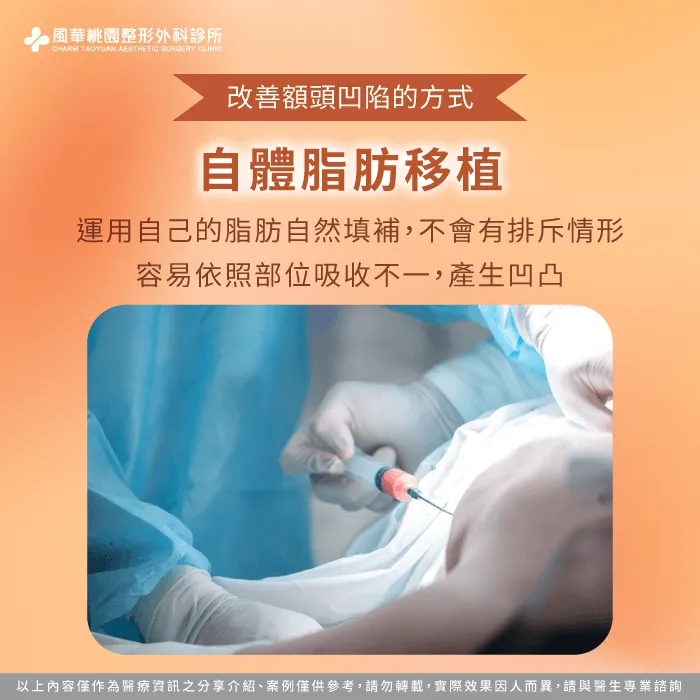 自體脂肪移植-額頭凹陷怎麼辦