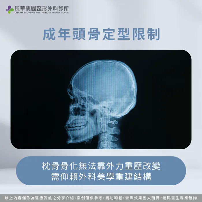 成年後頭骨發育定型需仰賴外科美學才能真正改變結構 枕骨骨化定型限制分析-後腦杓很扁怎麼辦?