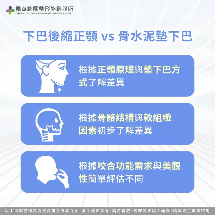 下巴後縮要正顎還是骨水泥墊下巴-下巴後縮正顎