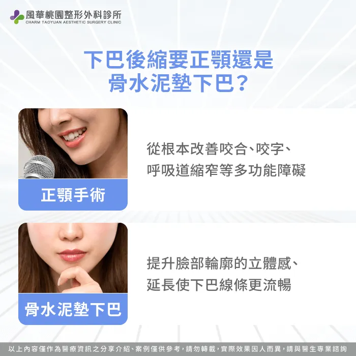 根據咬合功能需求與美觀性評估-下巴後縮正顎