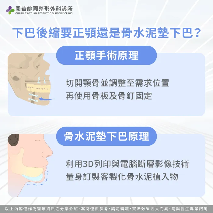 正顎原理與墊下巴原理比較-下巴後縮正顎