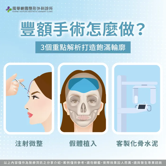 分析豐額手術關鍵重點-豐額手術方式