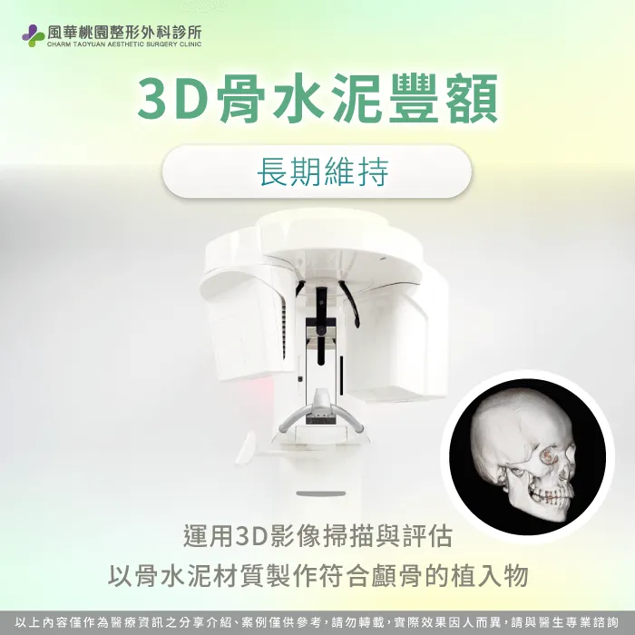 3D骨水泥豐額-扁額 骨水泥