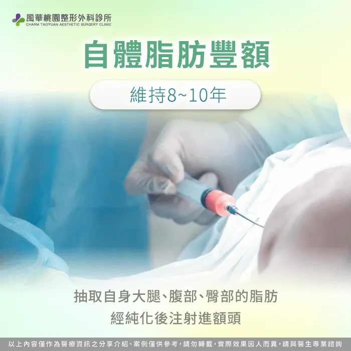 自體脂肪豐額-扁額 骨水泥