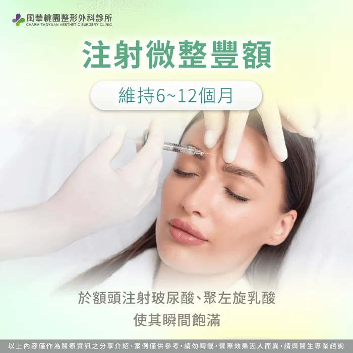 注射微整豐額-扁額 骨水泥