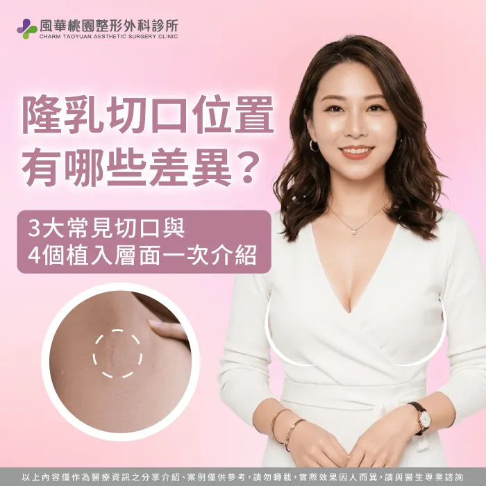 隆乳切口差異-隆乳切口位置