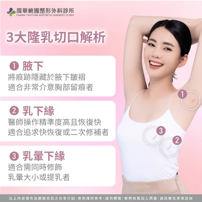 隆乳切口差異有哪些-隆乳切口差異