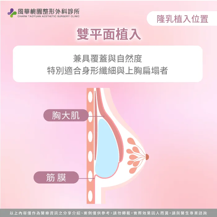 雙平面植入假體-隆乳切口差異