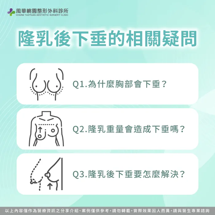隆乳後會下垂嗎-隆乳會下垂嗎