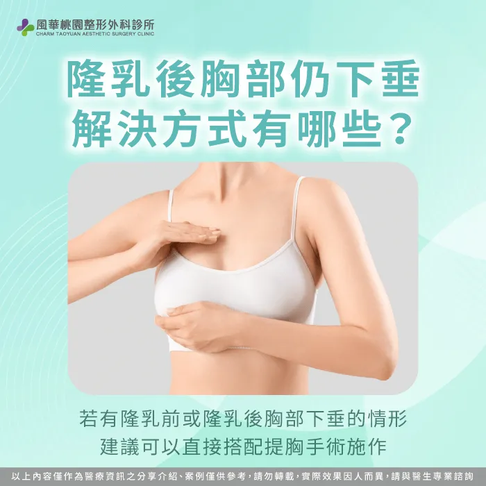 胸部下垂解決方式-隆乳後會下垂嗎
