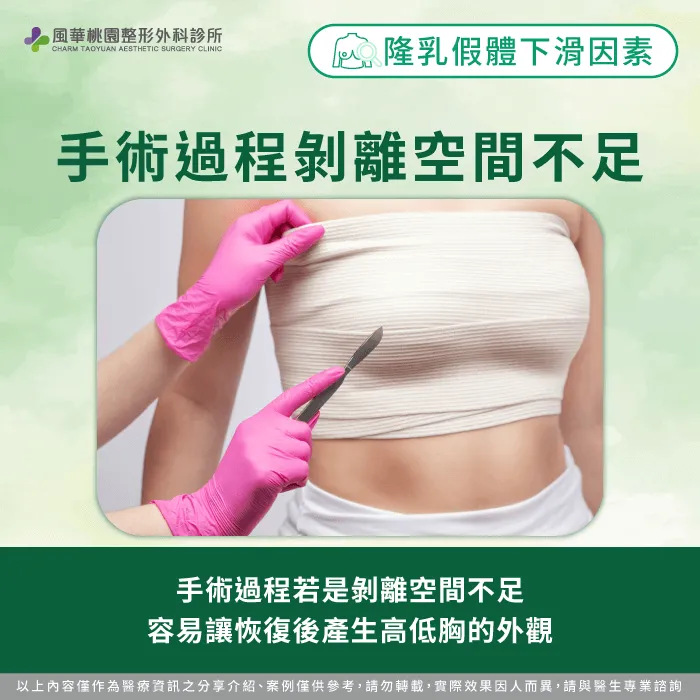 剝離空間不族-隆乳假體下降
