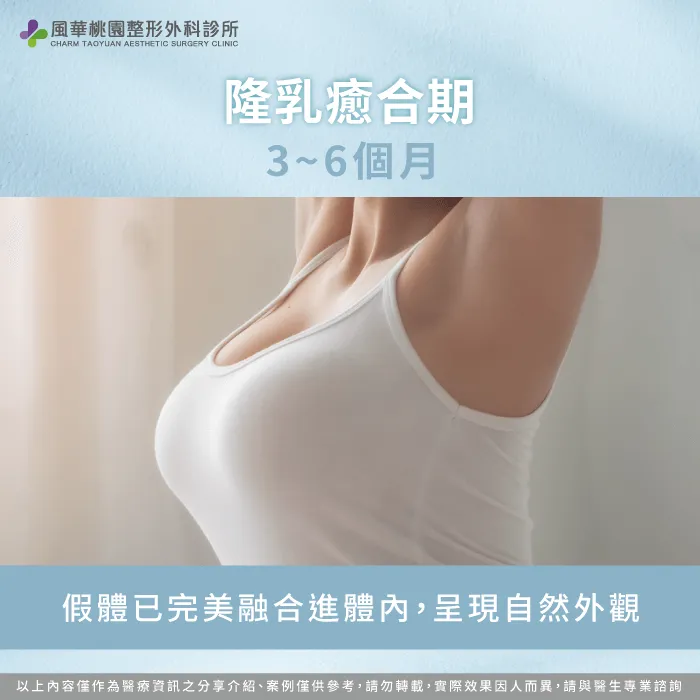 術後3~6個月-隆乳恢復期多久