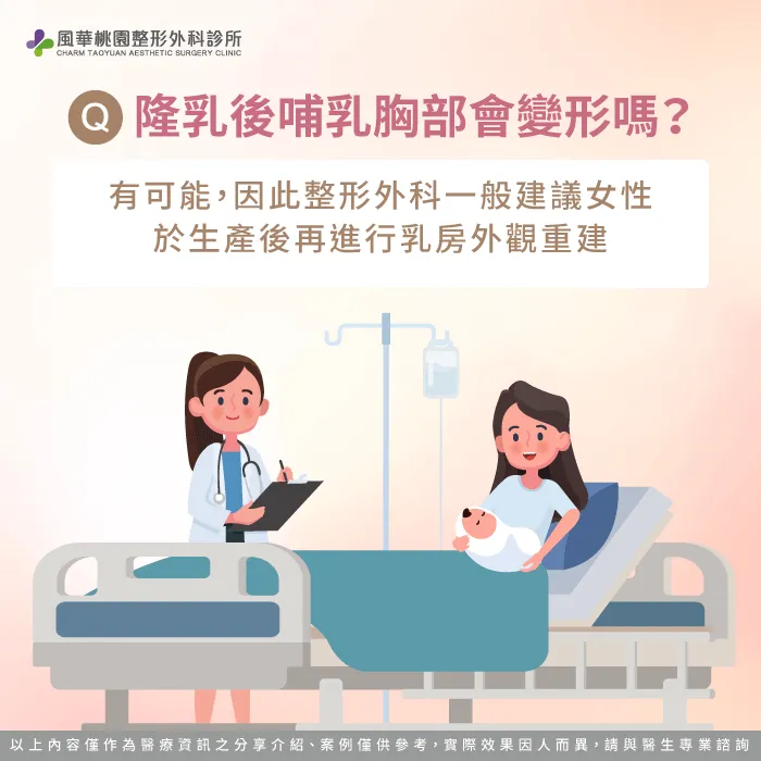 隆乳後哺乳胸部會變形嗎-隆乳可以哺乳嗎