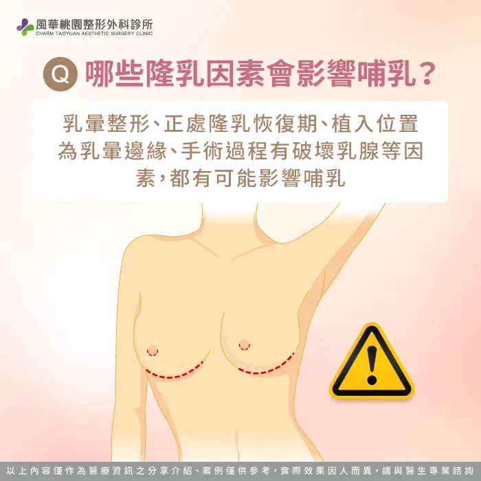 隆乳影響哺乳的因素-隆乳可以哺乳嗎