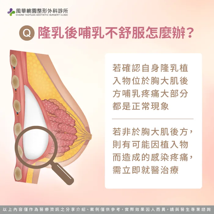 隆乳後哺乳疼痛因素-隆乳可以哺乳嗎