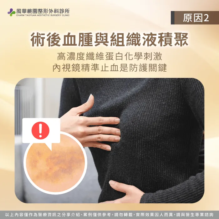 精密內視鏡止血技術能大幅提升隆乳課程的術後修復效率 術後殘留物刺激纖維增生-莢膜攣縮是什麼