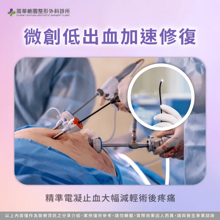 精準電凝止血技術讓術中出血量極少,大幅減輕術後疼痛並加快恢復步調 微創低出血與快速術後修復-內視鏡隆乳好處