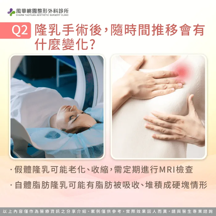 隆乳手術後變化-隆乳可以維持多久