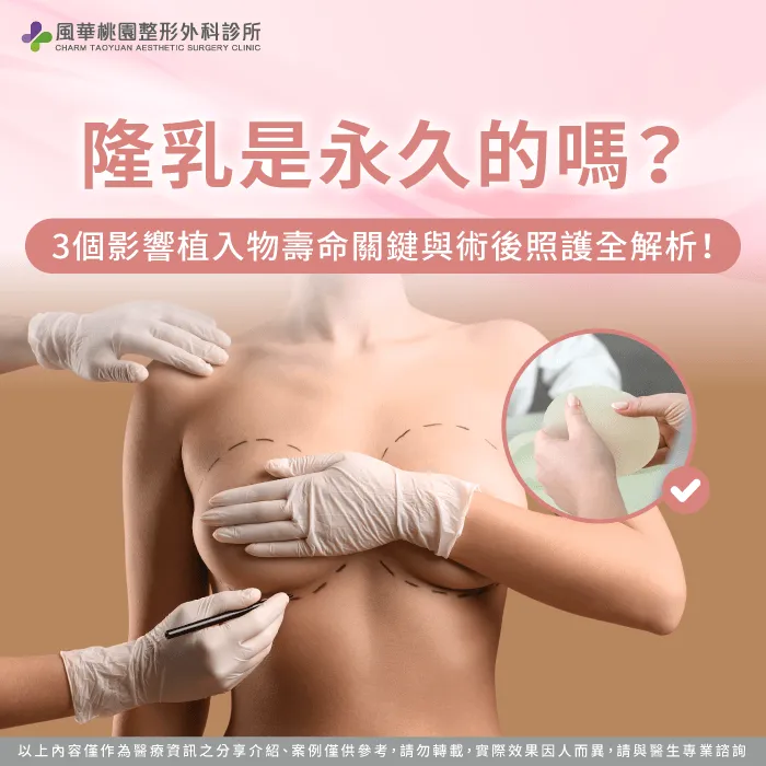 透過專業醫師評估假體材質與個人體質,能精準解答隆乳是永久的嗎 隆乳是永久的嗎解析與評估-隆乳是永久的嗎