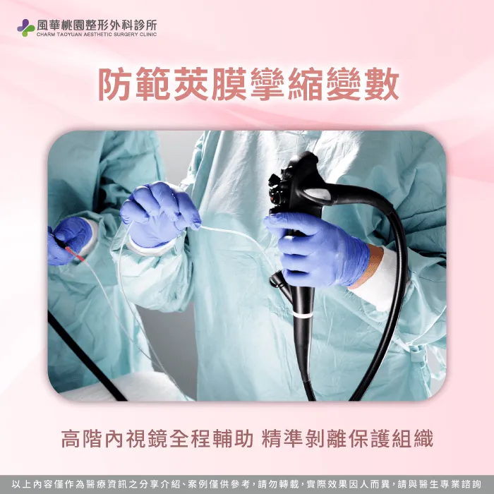 透過內視鏡精準剝離空間與優質表面材質,能顯著降低莢膜攣縮發生率 評估莢膜攣縮對胸型穩定度影響-隆乳可以永久嗎